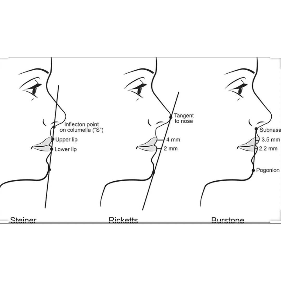 Before and After Image: Case 16 - front