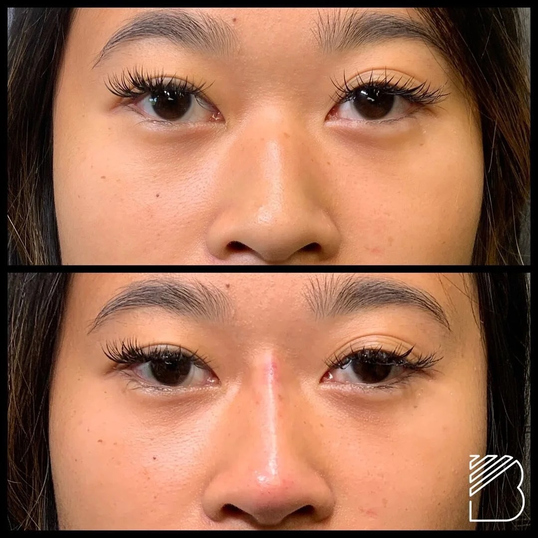 Before and After Image: Case 10 - front