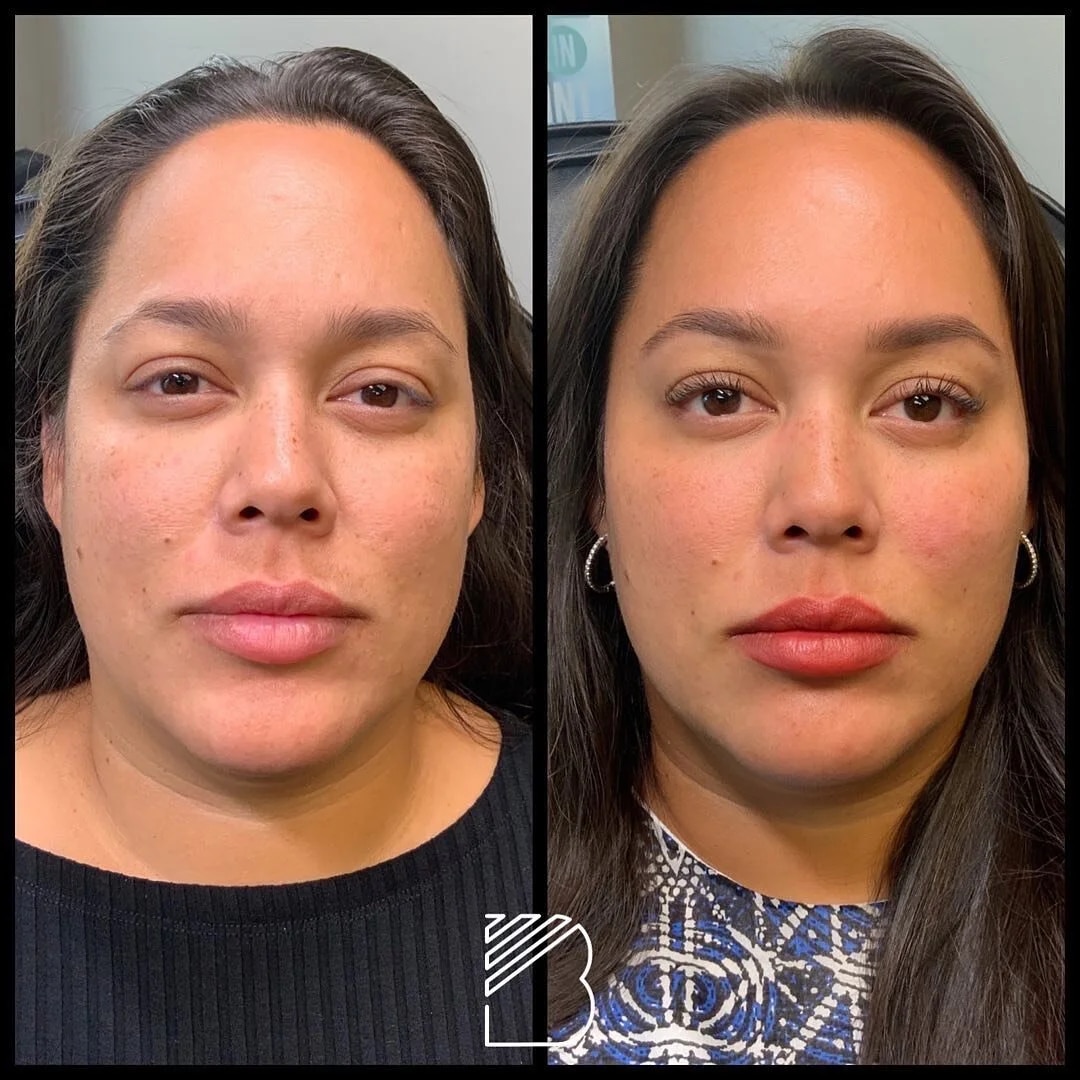 Before and After Image: Case 19 - front