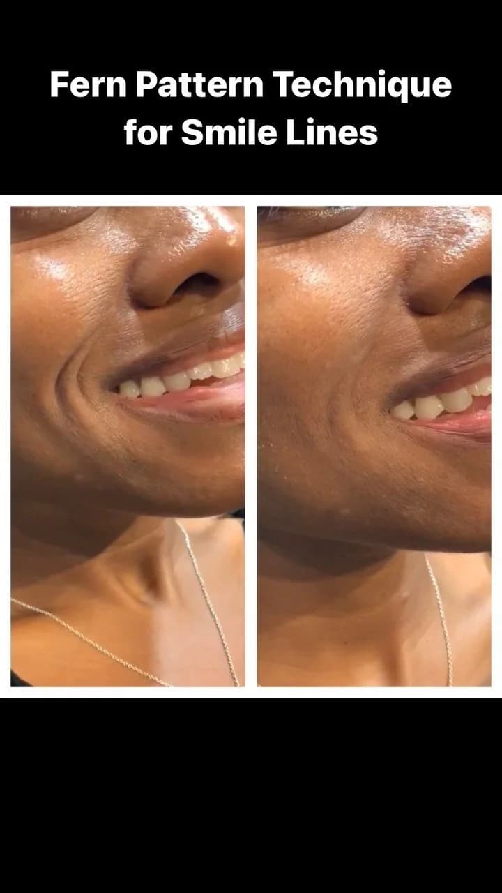 Before and After Image: Case 6 - front