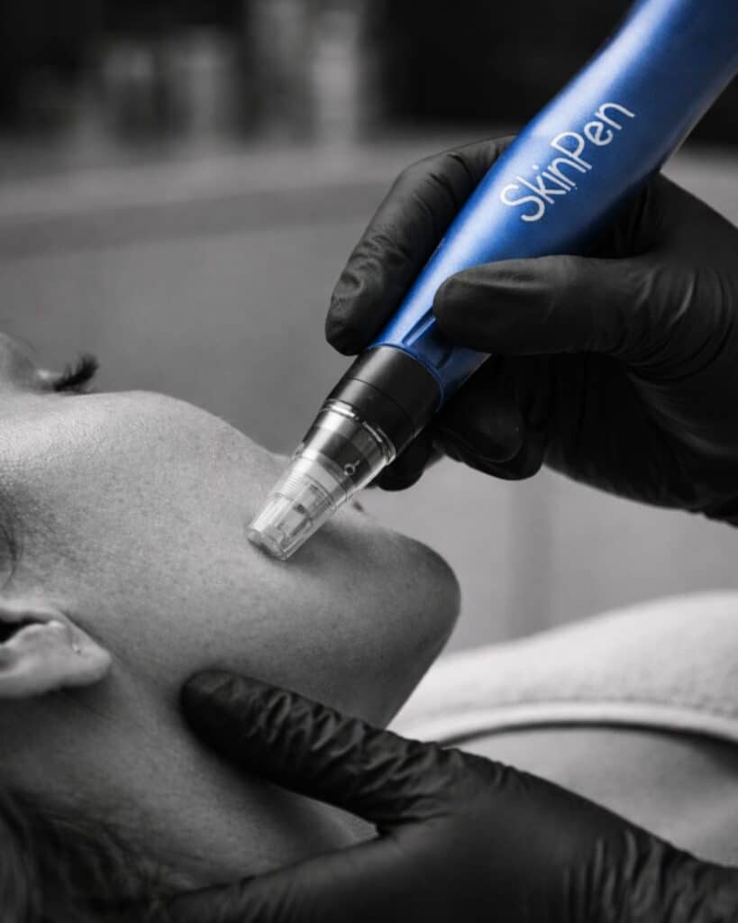 uMAJ4cC74JpyVttFJOtM