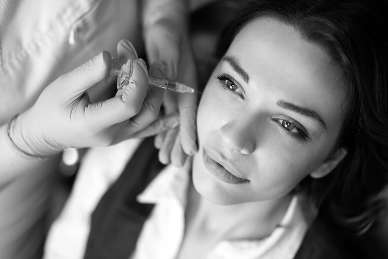 Woman looks up as her NP injects a dermal filler in her laugh lines